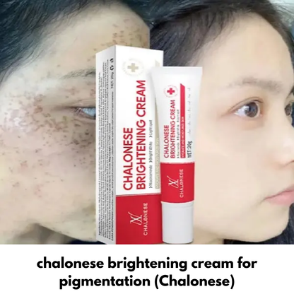 Chalonese Brightening Cream | (Both for Men & Women) گر 7 دن میں نتائج نہ ملیں تو مکمل رقم واپسI