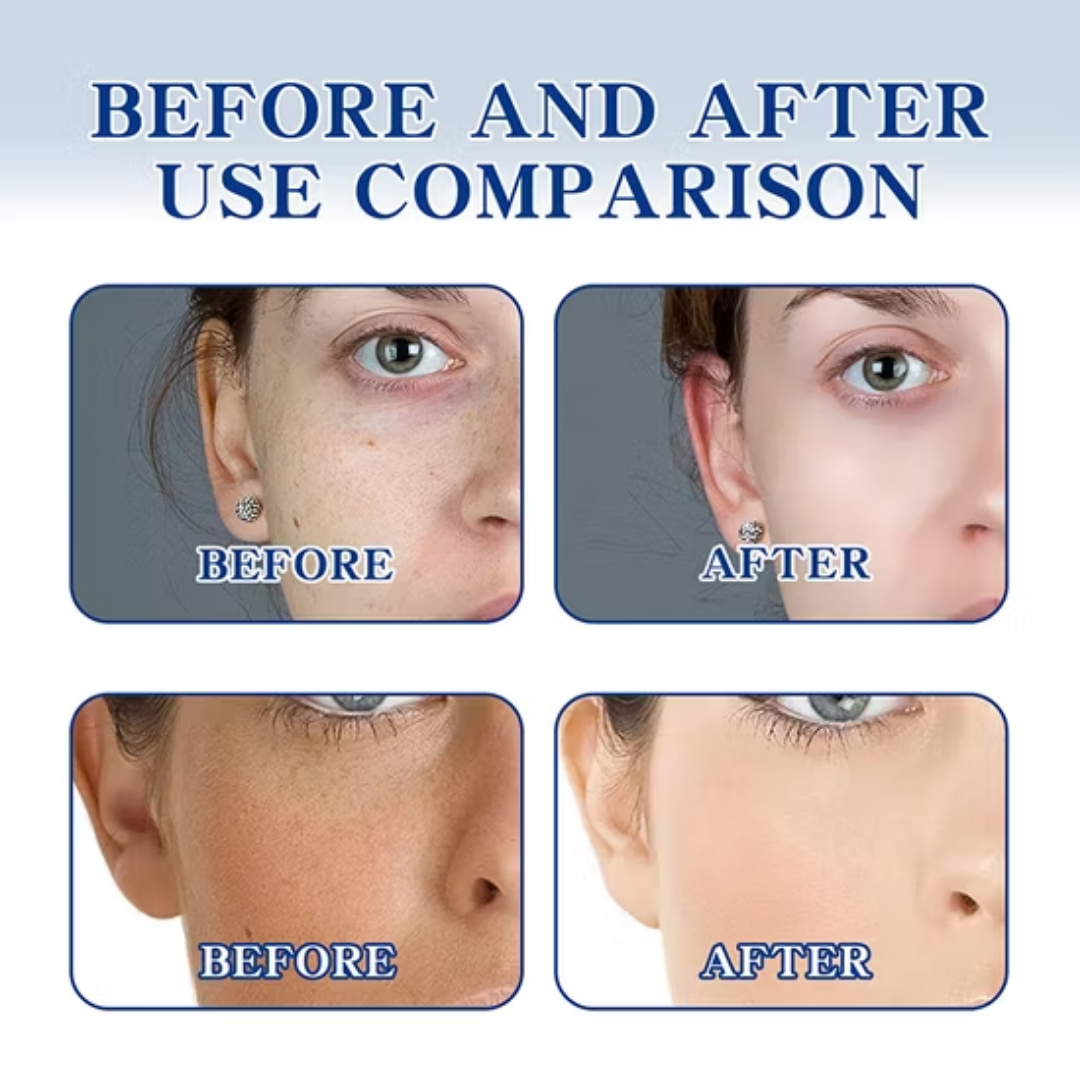 Chalonese Brightening Cream | (Both for Men & Women) گر 7 دن میں نتائج نہ ملیں تو مکمل رقم واپسI
